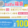 ミュゼプラチナムの脱毛料金はなぜ安い？料金の仕組みを徹底解説